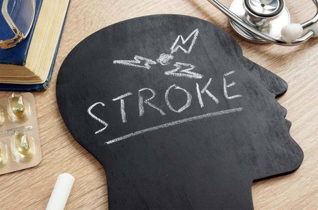 6-warning-symptoms-of-a-ministroke-mini-stroke-recovery-process